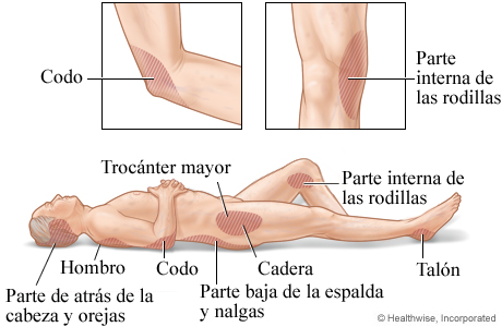 Puntos de presión en el cuerpo para prevenir lesiones